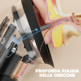 Irrigatore elettrico per la pulizia delle orecchie - ZeroCerume™ Pro