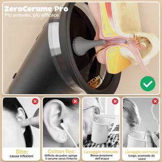 Irrigatore elettrico per la pulizia delle orecchie - ZeroCerume™ Pro