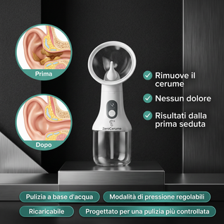 Irrigatore elettrico per la pulizia delle orecchie - ZeroCerume™